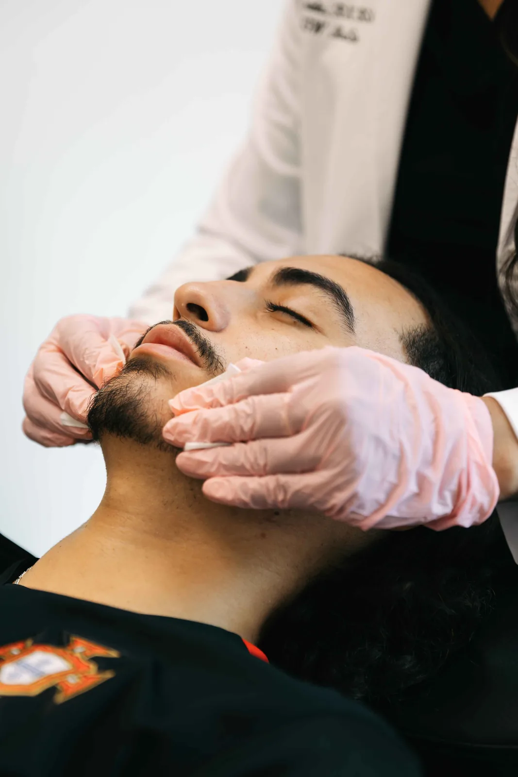 Chemical peel treatment