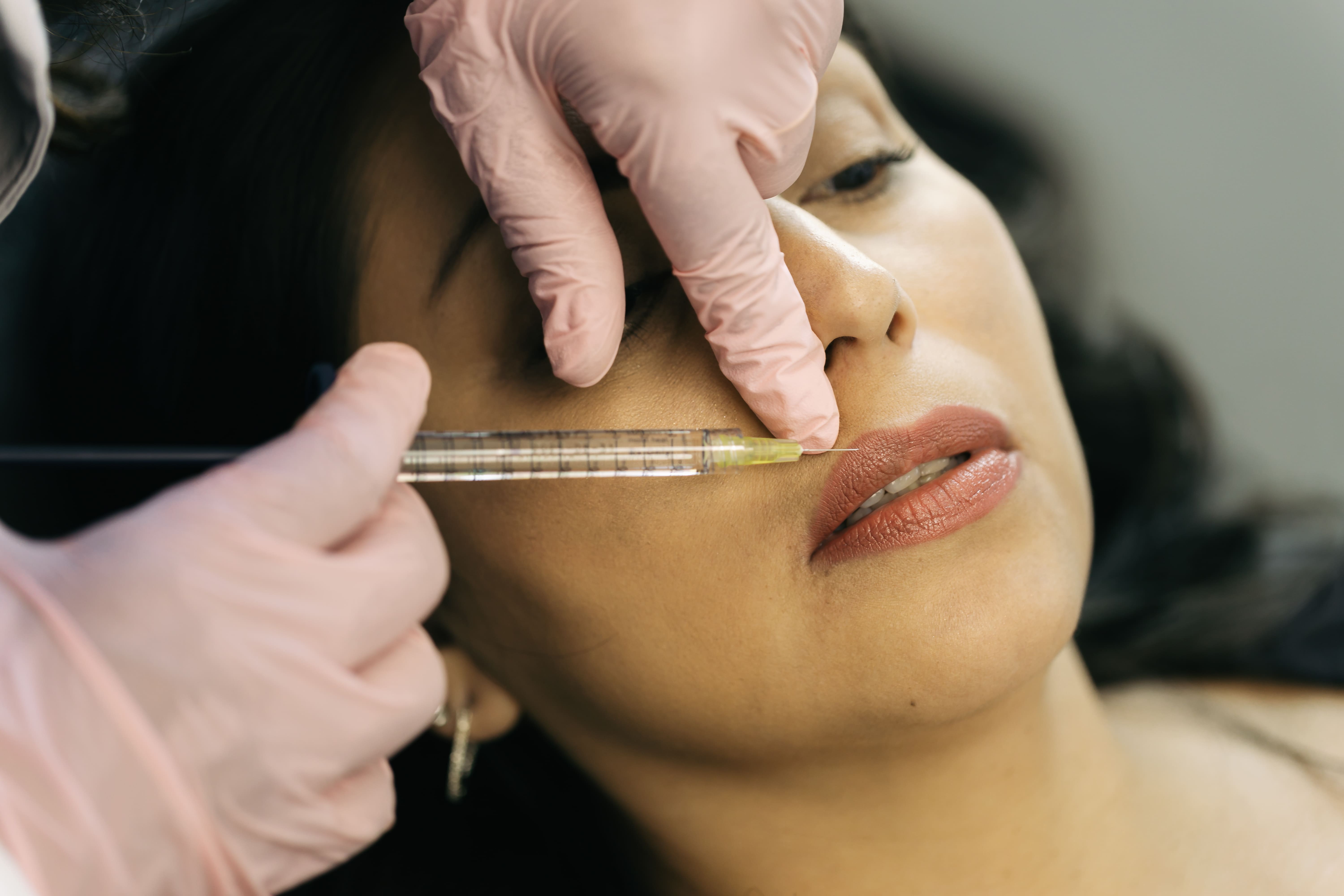 Dermal Fillers treatment