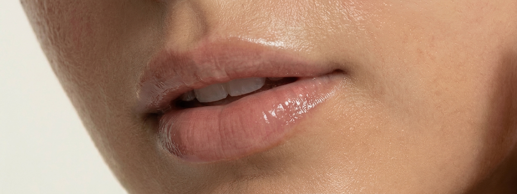 Lip filler augmentation