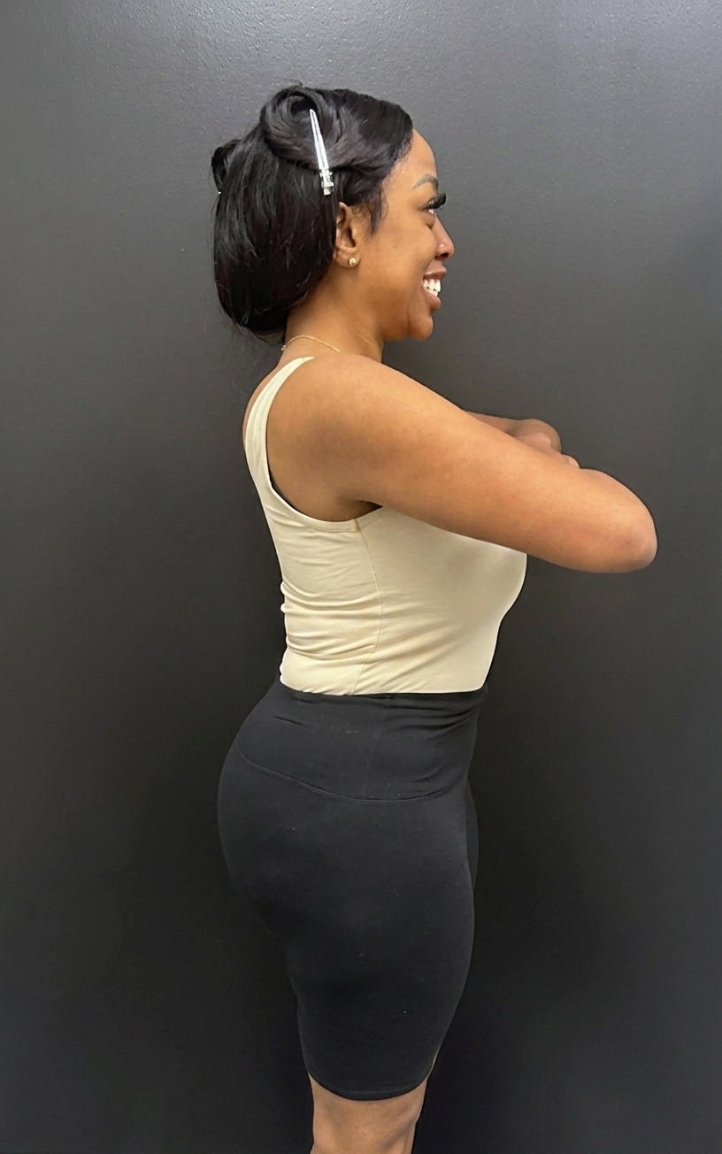 After weight loss program
