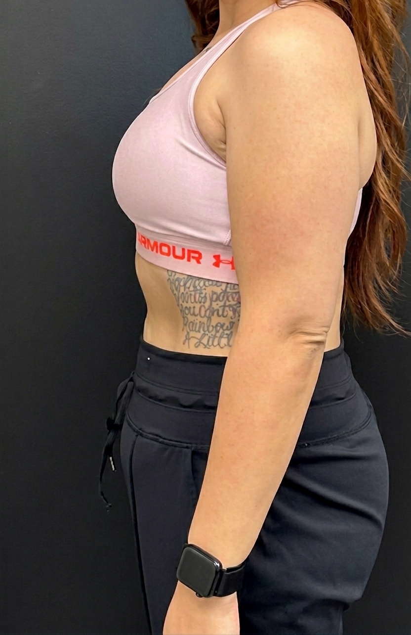 After weight loss program