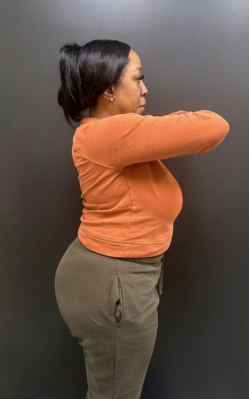 Before weight loss program