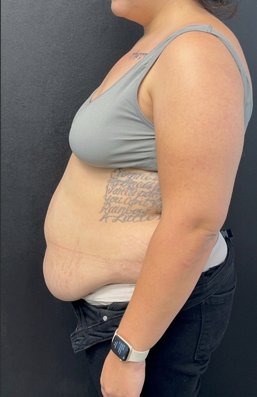 Before weight loss program
